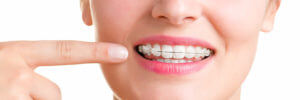 Ortodoncia dental